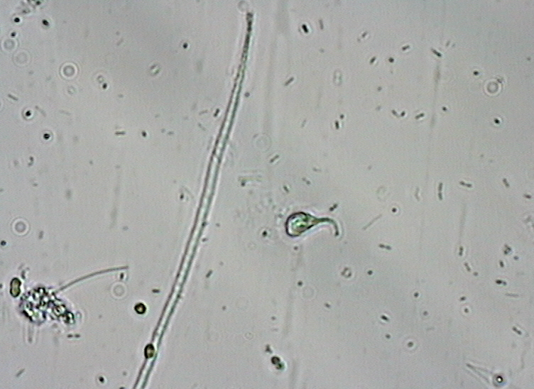 Dictyocha speculum